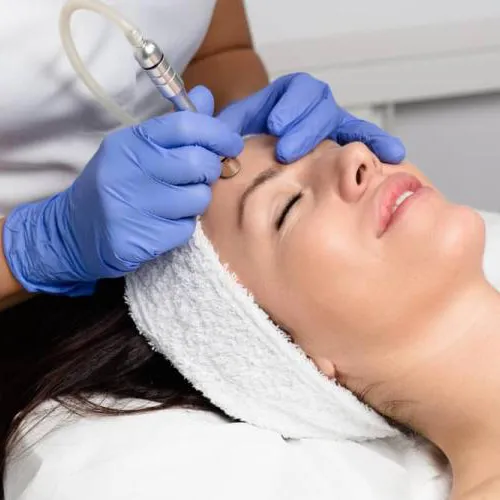 MICRODERMABRASION
